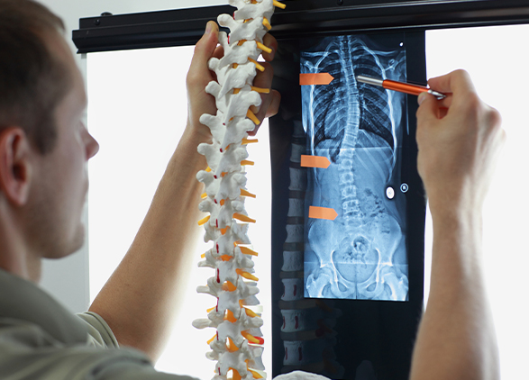 Spinal Cord Injury - TS